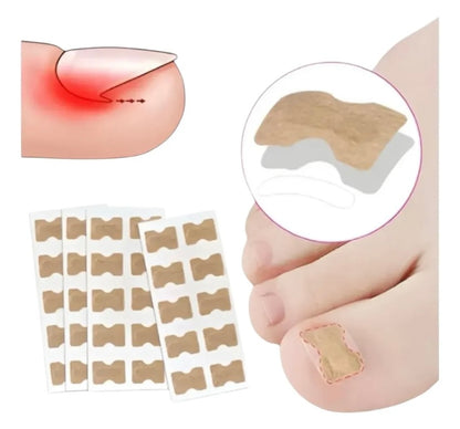 PARCHES UÑAS ENCARNADAS